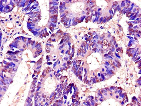 RTCB / C22orf28 Antibody