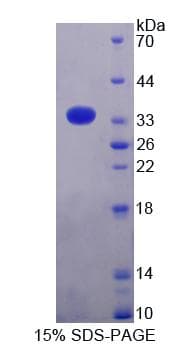 Rat AZIN1 Protein (Recombinant His-T7)