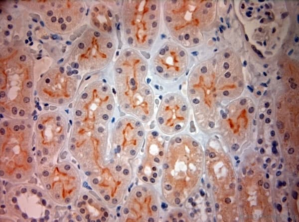 Polyclonal Rabbit anti-Human SLC17A3 Antibody (aa2-50, IHC)