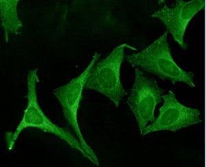 IHC-plus™ Polyclonal Rabbit anti-Human CANX / Calnexin Antibody (C-Terminus, IHC, IF, WB)