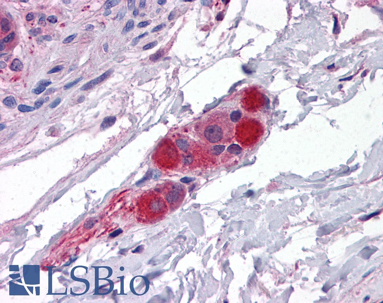 IHC-plus™ CDC42BPA / MRCK Antibody (aa2-14)
