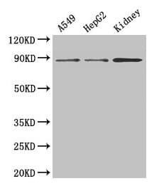 IHC-plus™ Junctin / ASPH Antibody