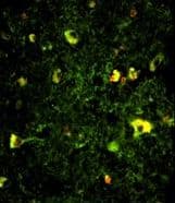 PathPlus™ Polyclonal Rabbit anti-Human RAB5A / RAB5 Antibody (aa182-211, IHC, IF, WB)