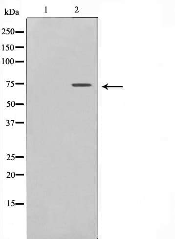 SMIF / DCP1A Antibody