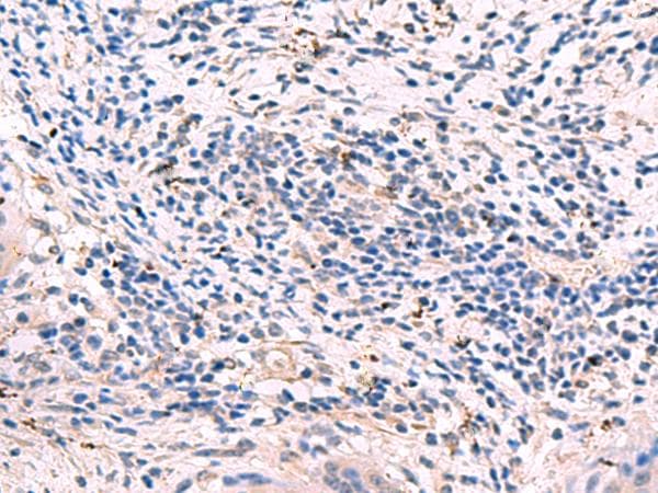GKAP1 Antibody