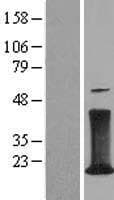 Human CD247 / CD3 Zeta Protein (Over-Expression Lysate Myc-DDK (Flag))