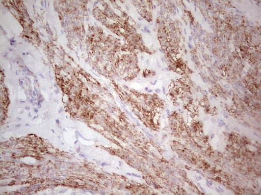 CSNK1G1 / CKI-Gamma 1 Antibody (aa163-422, clone OTI1D7)