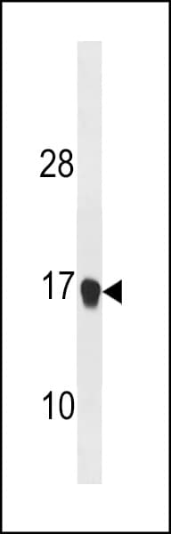 Polyclonal Rabbit anti-Mouse CDKN1A / WAF1 / p21 Antibody (aa126-154, WB)