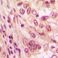 CDCA8 / Borealin Antibody