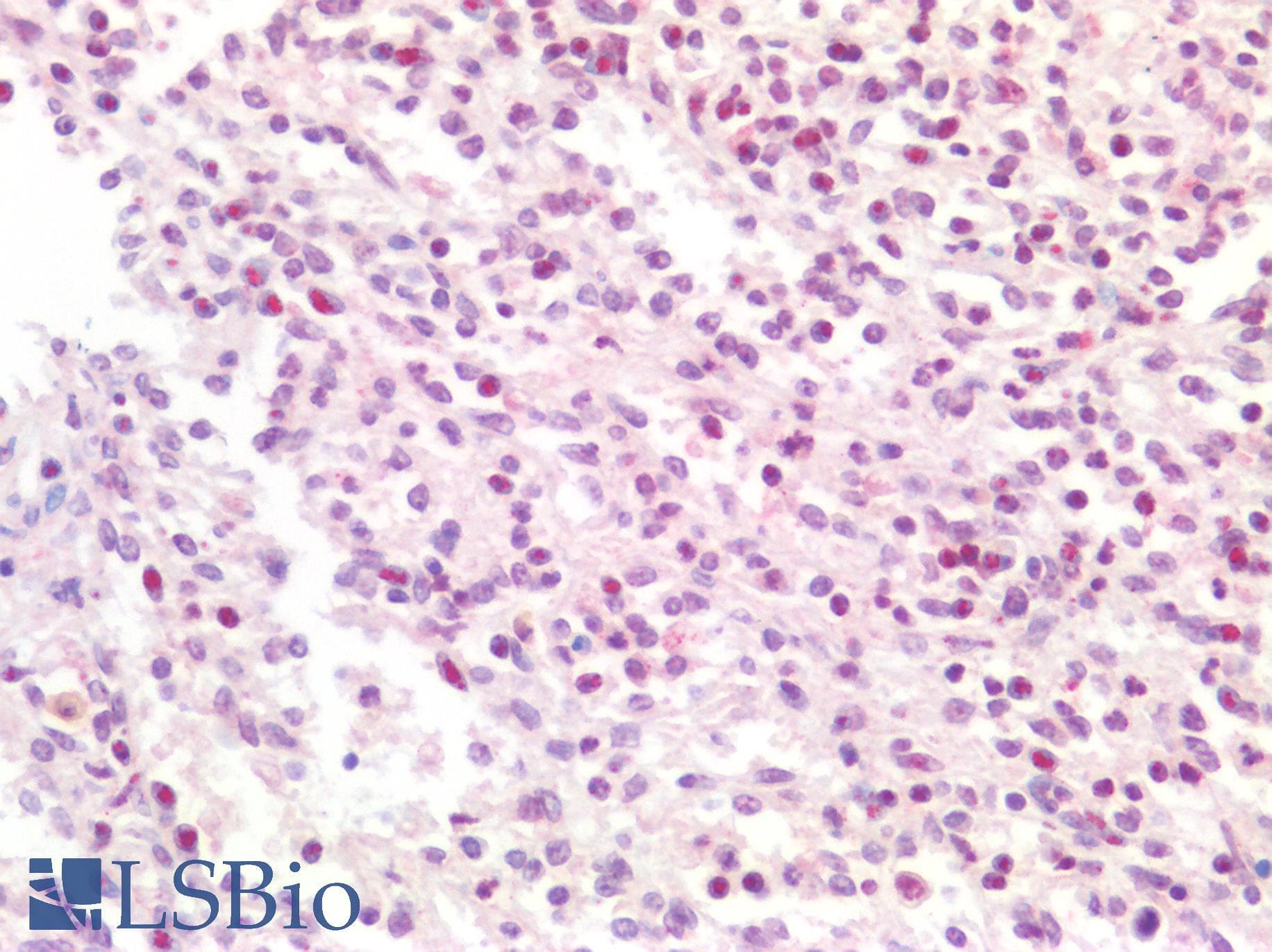 PathPlus™ Polyclonal Rabbit anti-Human FOXP1 Antibody (aa650-677, IHC, WB)