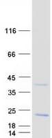 Human PRAF2 Protein (Recombinant Myc-DDK (Flag))