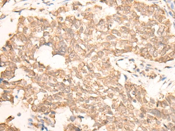 Polyclonal Rabbit anti-Human C11orf30 / EMSY Antibody (IHC)