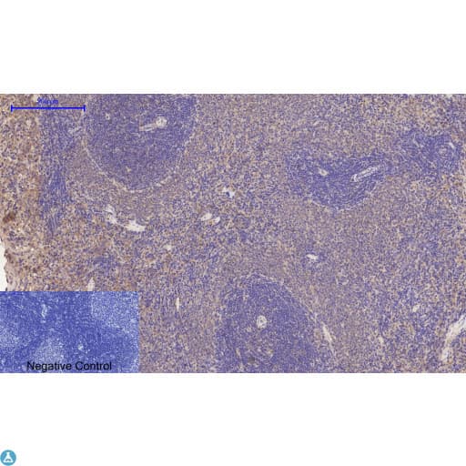 Polyclonal Rabbit anti-Human APP / Beta Amyloid Precursor Antibody (WB)