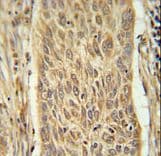 Polyclonal Rabbit anti-Human INMT Antibody (aa101-128, IHC, WB)