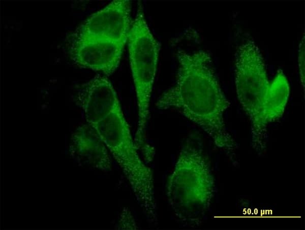 IHC-plus™ Monoclonal Mouse anti-Human Gasdermin D / GSDMD Antibody (clone 3F12-1B2, IHC, IF)