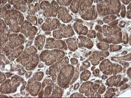 UBE2G2 Antibody (clone OTI4E12)
