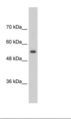 Polyclonal Rabbit anti-Human SLC13A3 Antibody (aa256-305, IHC, WB)