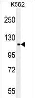 Polyclonal Rabbit anti-Human TDRD1 Antibody (aa966-995, WB)