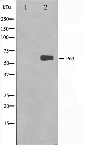 Polyclonal Rabbit anti-Human TP63 / p63 Antibody (IF, WB)