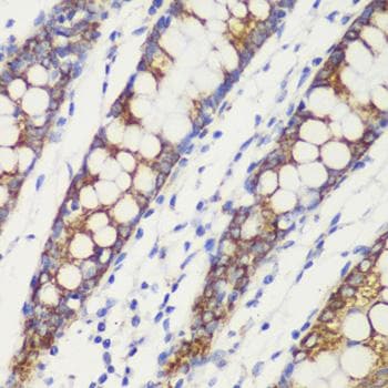 Polyclonal Rabbit anti-Human TOMM20 Antibody (IHC, IF)