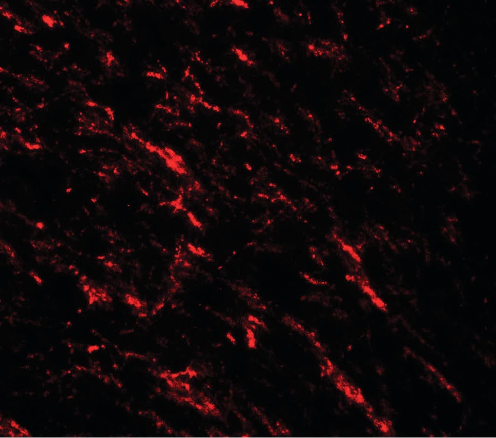 KAT5 / TIP60 Antibody