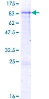 Human HEXB Protein (Recombinant GST)