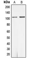 Polyclonal Rabbit anti-Human AR / Androgen Receptor Antibody (phospho-Ser650, IHC, WB)