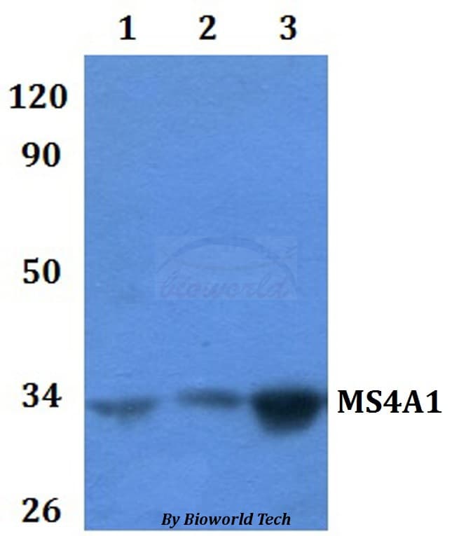 CD20 Antibody