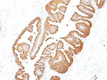 KLK3 / PSA Antibody (clone KLK3/801, Ready-to-Use)