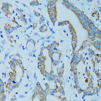 KRT15 / CK15 / Cytokeratin 15 Antibody