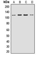 Polyclonal Rabbit anti-Human ACAP2 / Centaurin Beta 2 Antibody (WB)