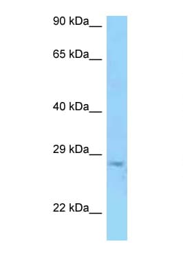 PRSS58 Antibody (aa166-215)
