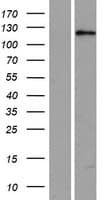 USP53 Protein (Over-Expression Lysate Myc-DDK (Flag))