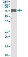 Monoclonal Mouse anti-Human LIPG / Endothelial Lipase Antibody (clone 4A9, WB)
