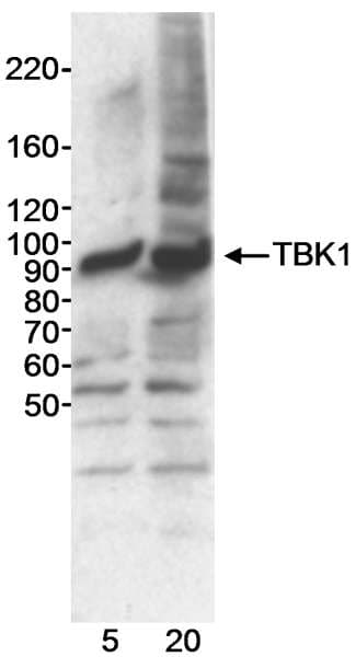 Polyclonal Rabbit anti-Human NAK / TBK1 Antibody (aa675-C-term, WB)