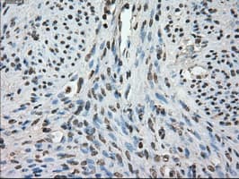 FCGR2 / CD32 Antibody (clone OTI19C10)