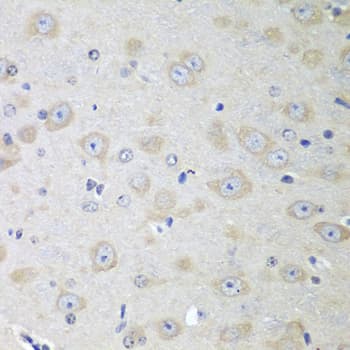 IHC-plus™ YES1 / c-Yes Antibody