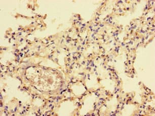 Polyclonal Rabbit anti-Human NFI / NFIC Antibody