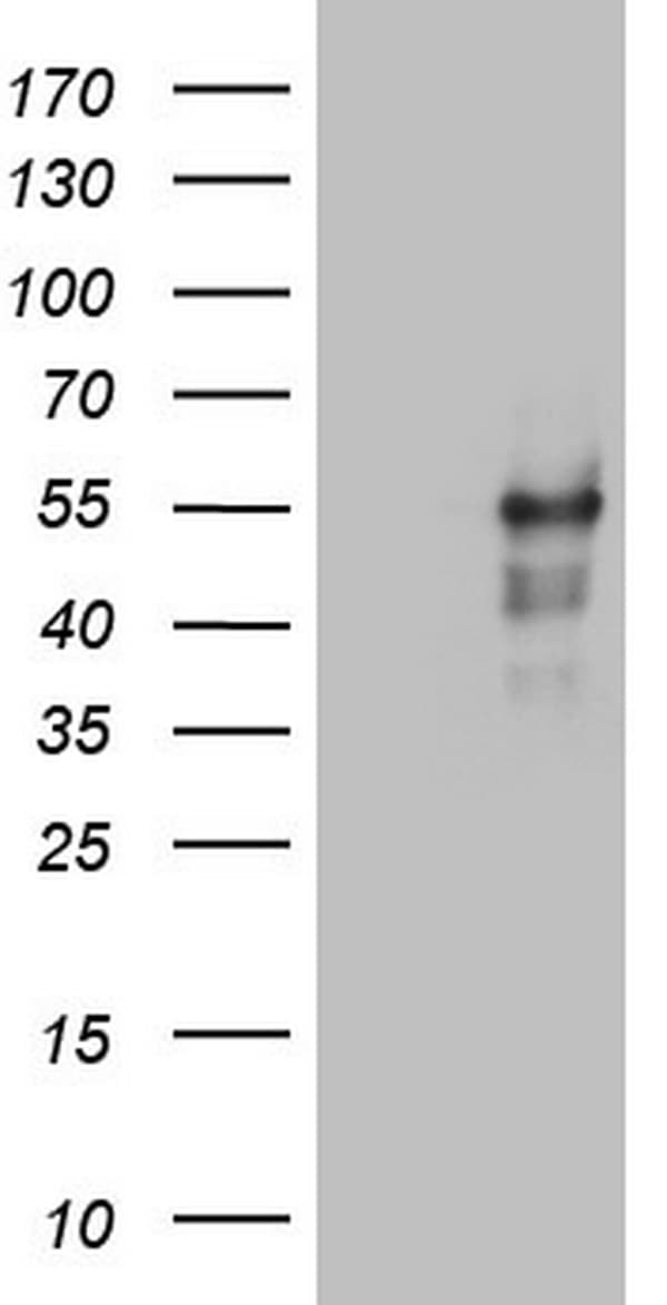 LRRC6 Antibody (clone OTI2F8, Carrier-free)