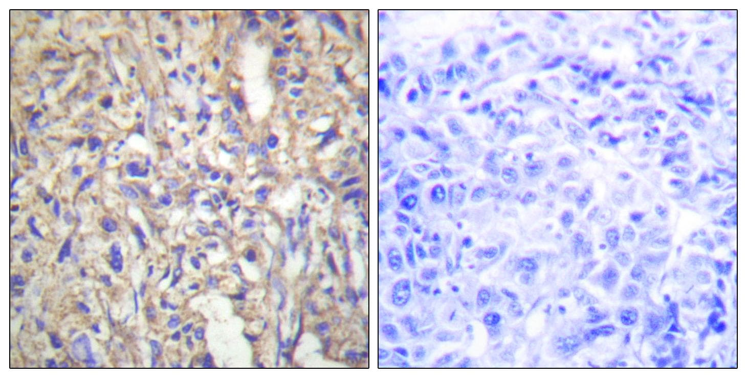 LAMB1 / Laminin Beta 1 Antibody