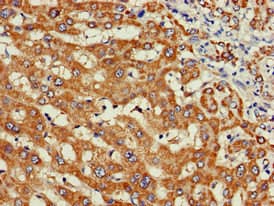 Polyclonal Rabbit anti-Human WISP3 Antibody (IHC, WB)