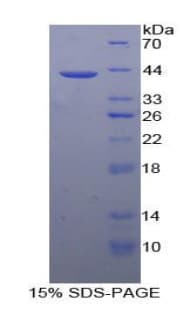 Mouse TFF1 / pS2 Protein (Recombinant His-GST)