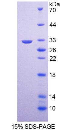 Human KLK9 / Kallikrein 9 Protein (Recombinant His-T7)