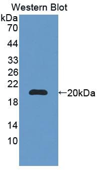 BRCC3 / BRCC36 Antibody (aa7-148, Biotin)