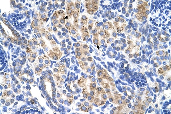 ALDH3A2 Antibody (aa351-400)