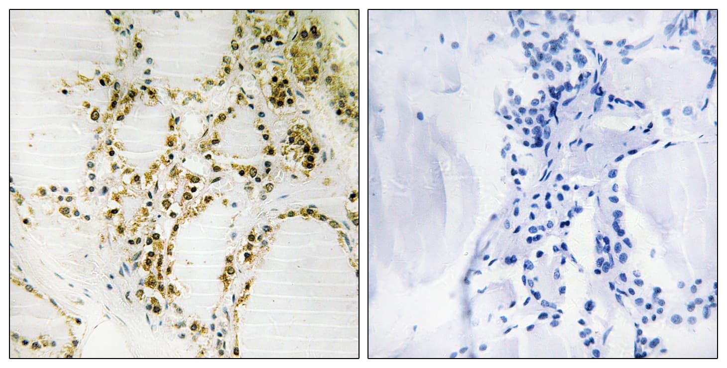 Polyclonal Rabbit anti-Human EP300 / p300 Antibody (phospho-Ser89, IHC)
