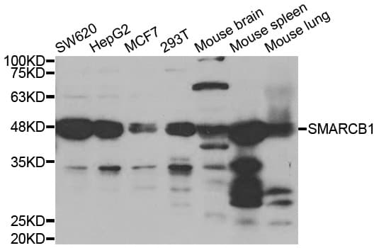 PathPlus™ SMARCB1 / INI1 Antibody