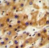 Polyclonal Rabbit anti-Human GAGE13 Antibody (aa1-30, IHC, WB)