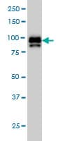 IHC-plus™ IFI16 Antibody (clone 2E3)