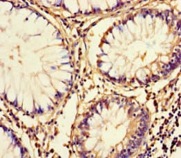 Polyclonal Rabbit anti-Human FAM161A Antibody